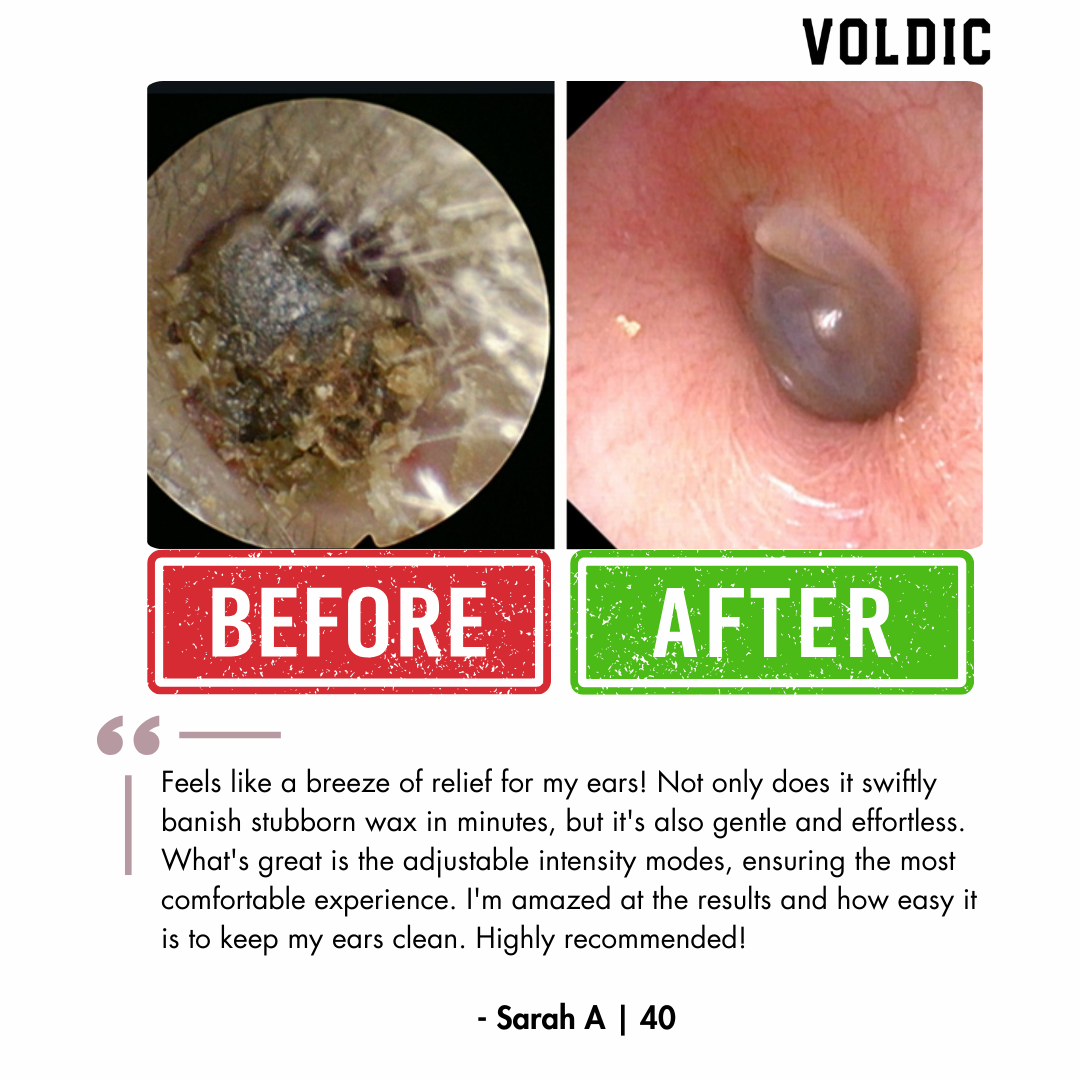 Voldic™ Electric Ear Wax Removal Kit (Limited Discount)