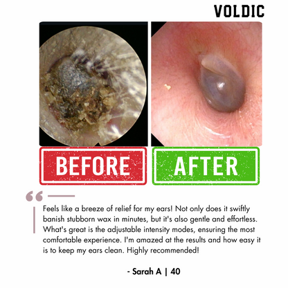 Voldic™ Electric Ear Wax Removal Kit (Limited Discount)