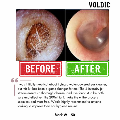 Voldic™ Electric Ear Wax Removal Kit (Limited Discount)