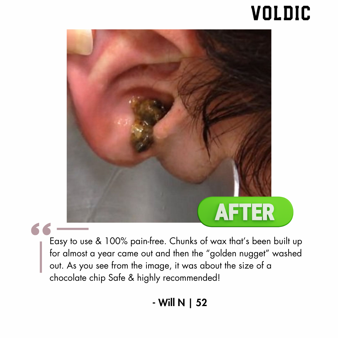 Voldic™ Electric Ear Wax Removal Kit (Limited Discount)