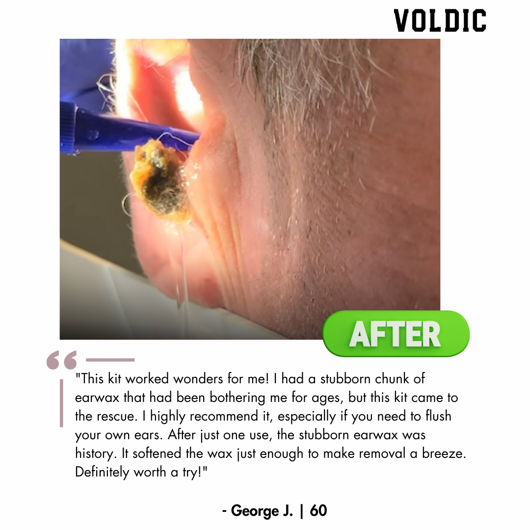 Top 5 Ear Wax Removal Kits – Voldic