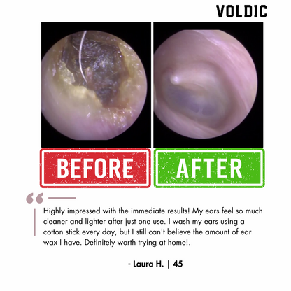 Voldic™ Electric Ear Wax Removal Kit (Limited Discount)